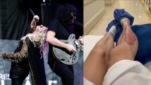 Taylor Momsen hospitalizada: “Hospital hoy, concierto mañana… las arañas venenosas no son ninguna broma”